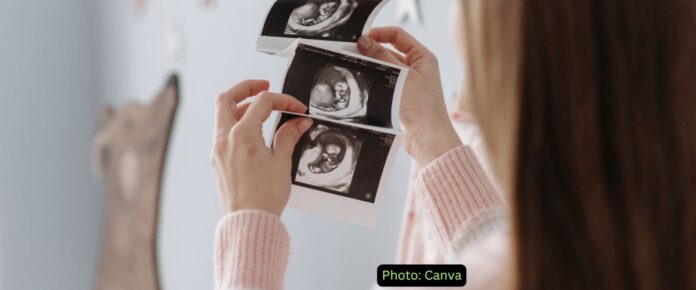 Neuroanatomical Remodeling in Pregnancy Unveiled