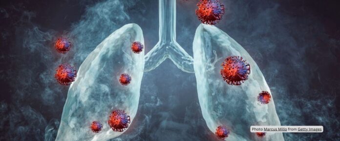 No Surge in Respiratory Illness