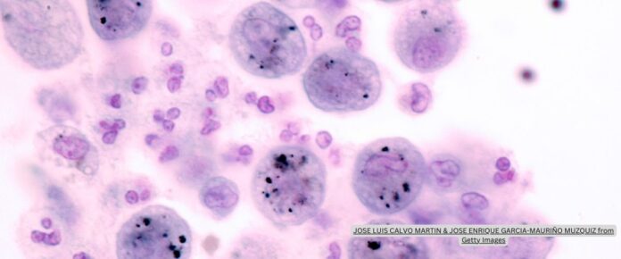 Imaging Phagocytic Force Over Surface-bound Particles by Macrophages