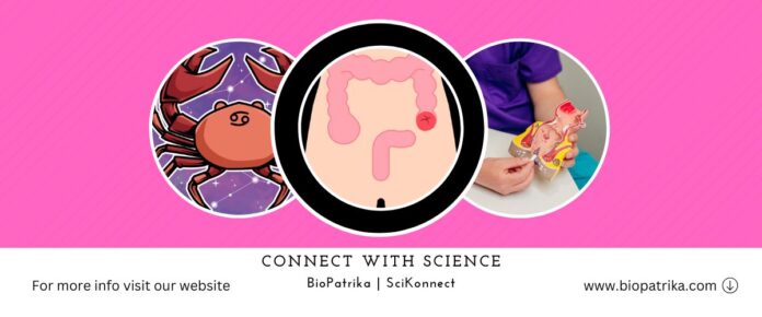 Model systems and therapeutic vulnerabilities for colorectal signet-ring cell carcinomas