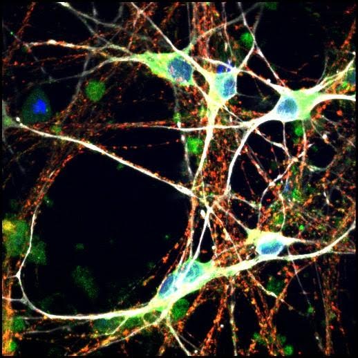 Breaking Down Storage Brain Sugar May Help Fight Neurodegeneration Figure