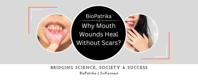 Why Mouth Wounds Heal Without Scars