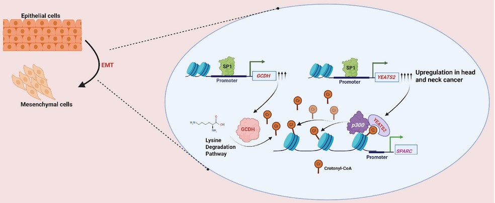 Interplay of epigenome and cancer metabolism may explain why some tumors might be more aggressive than others