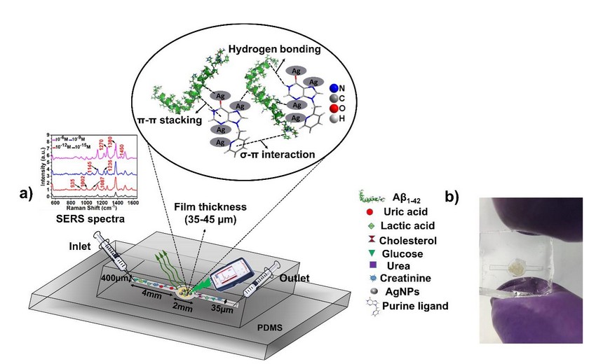 Microfluidic Device Prototype for Early Detection of Alzheimer
