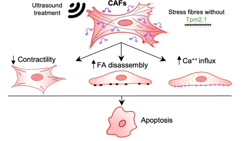 miR-21 in oral tumor microenvironment suppresses Tpm2.1 expression in CAFs. Tpm2.1-depleted CAFs show mechanical vulnerability against US treatment and undergo mechanoptosis.