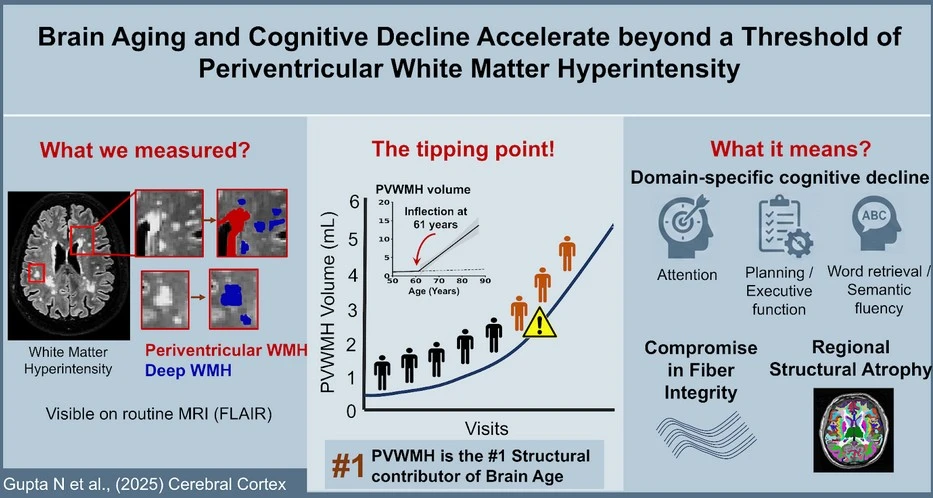 Axonal Pruning Shapes How Our Brains Age