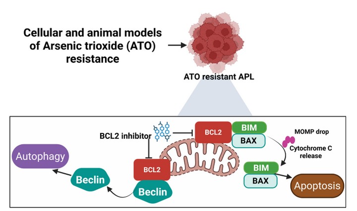 Breakthrough Study Shows Venetoclax Reverses Drug Resistance in Relapsed APL