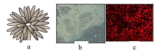 BAP1 Orchestrating the Transition from Pluripotency to neuronal differentiation