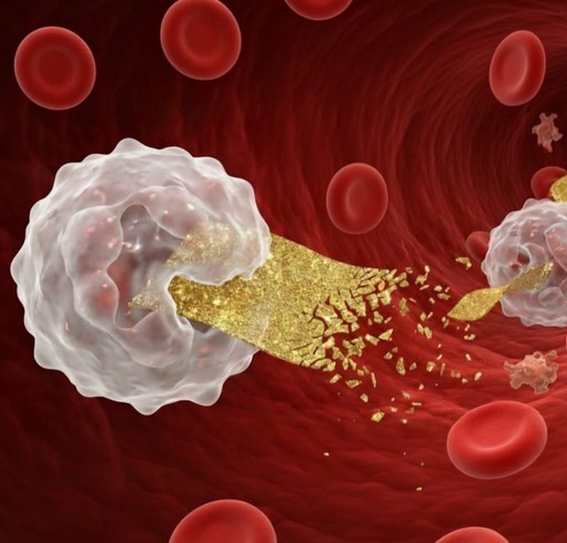 Human Blood Neutrophils Can Degrade Gold Nanomaterials