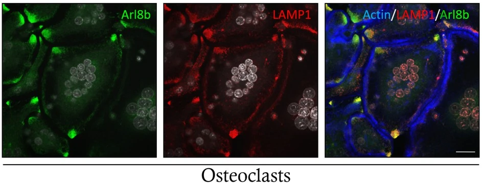 The Bone Balancing Act Decoding Osteoclasts