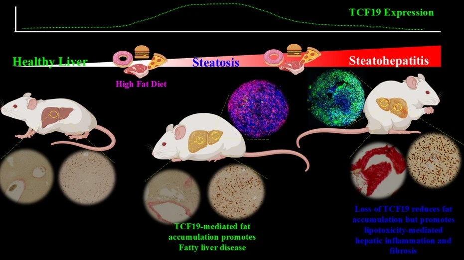 The Lipid Paradox in MAFLD Through an Epigenetic Lens