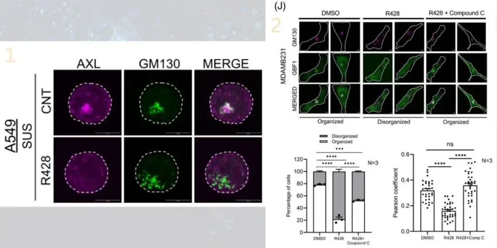 AXL regulates Golgi organization and function in cancer cells