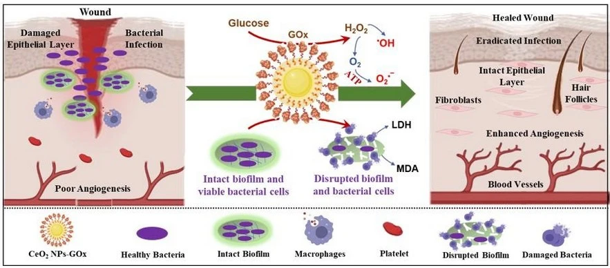 Super Nanozyme Rapidly Eliminates MRSA and Accelerates Wound Healing