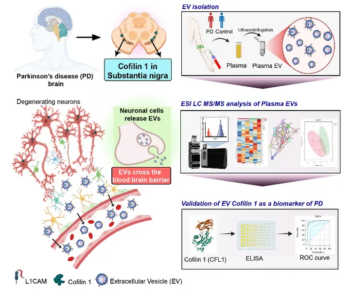 Extracellular Vesicle Cofilin-1 Emerges as a Potential Biomarker for Parkinson’s Disease
